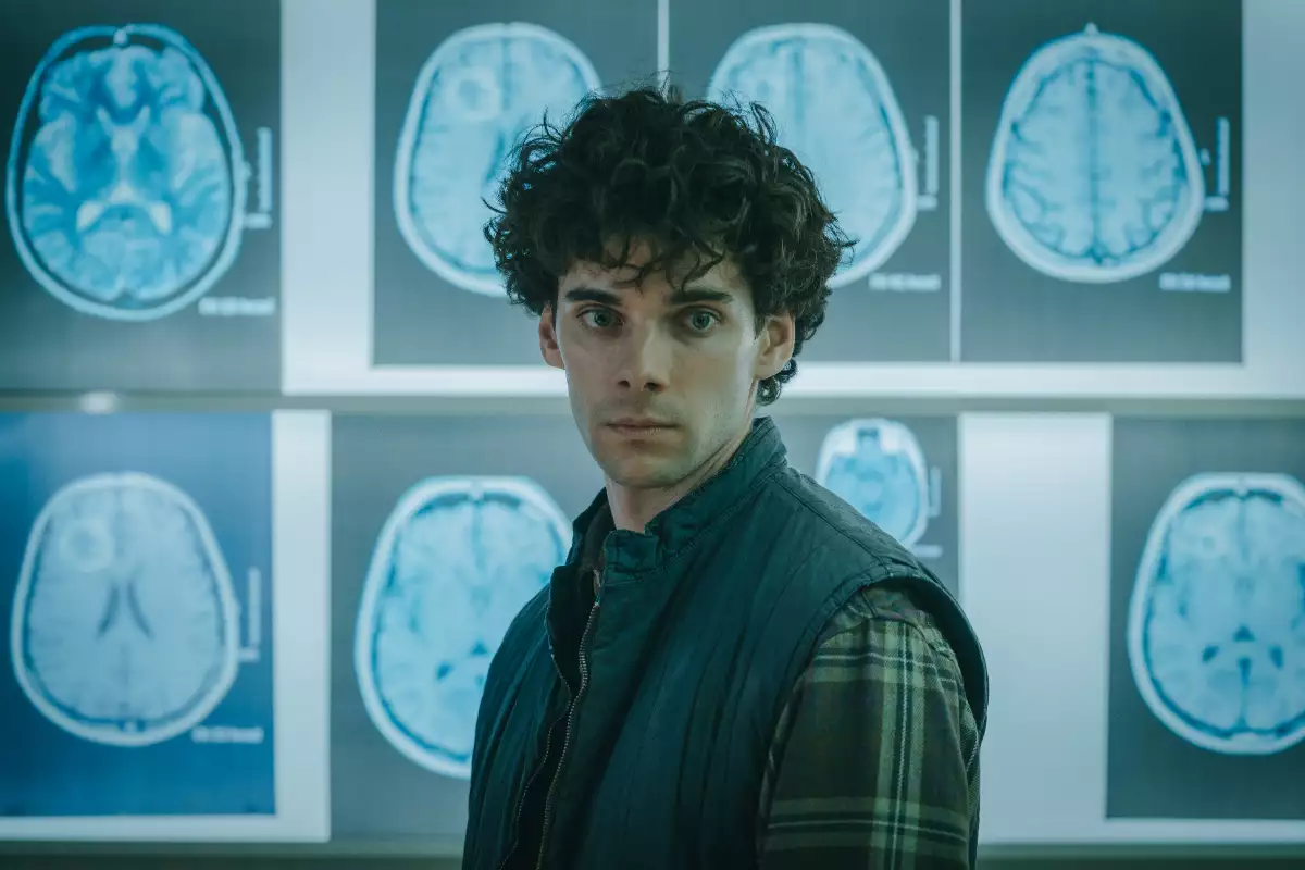 Foto de Élmer, personaje interpretado por Álvaro Rico, y al fondo se ven tomografías de su cerebro.