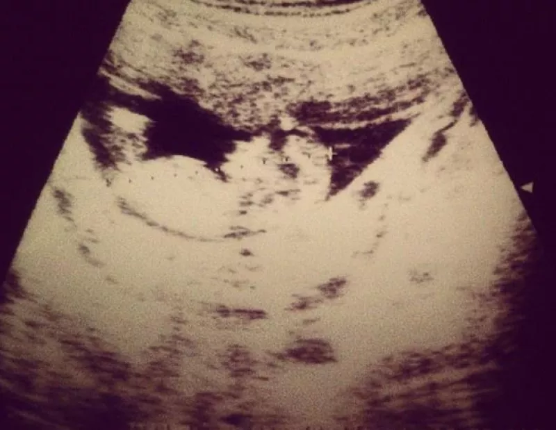 Ella y su esposo Kicho Rivera esperan a su segundo bebé, a menos de un año del nacimiento de su primogénito. Será niña y se llamará Carlota.