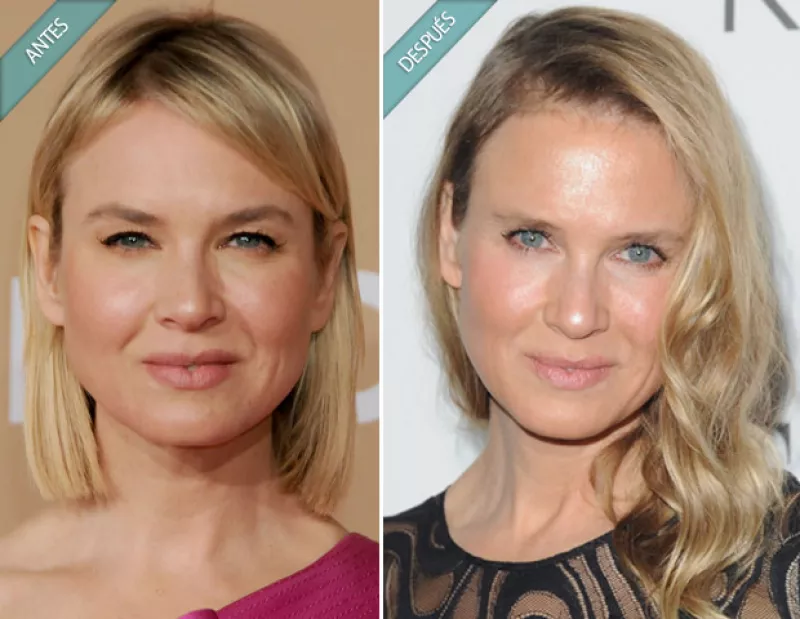 La actriz decidió finalmente hablar sobre las críticas que ha recibido desde hace unos años y en el comunicado, habla sobre su supuesta operación de ojos.