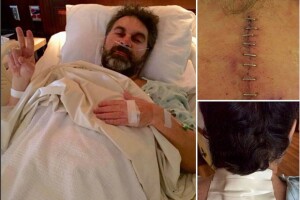 Mijares mostró en foto su herida tras la cirugía.