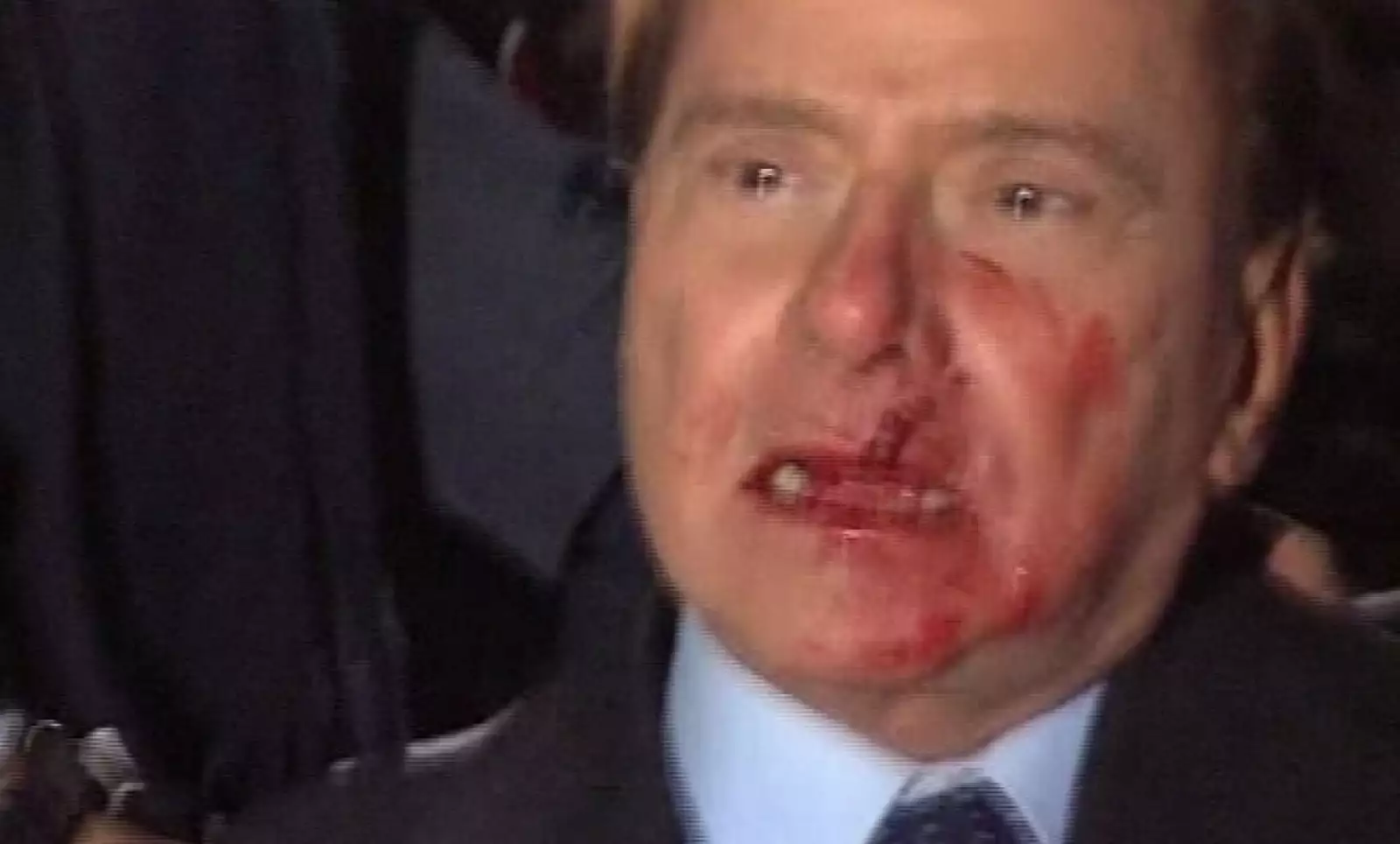 La imagen dio la vuelta al mundo en menos de una hora, el rostro ensangrentado y desconcertado de Berlusconi mostró el desencanto de la población italiana en su primer mandatario; fue dado de alta el jueves sin ningún tipo de lesión grave.