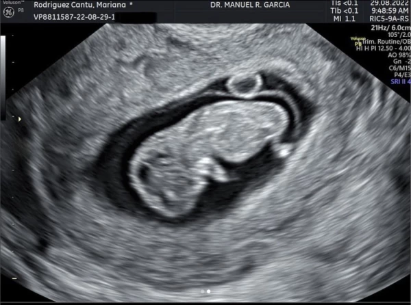 Bebe- Mariana-Rodriguez-cantu Samuel-Garcia.jpeg