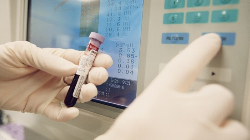 prueba sangre laboratorio