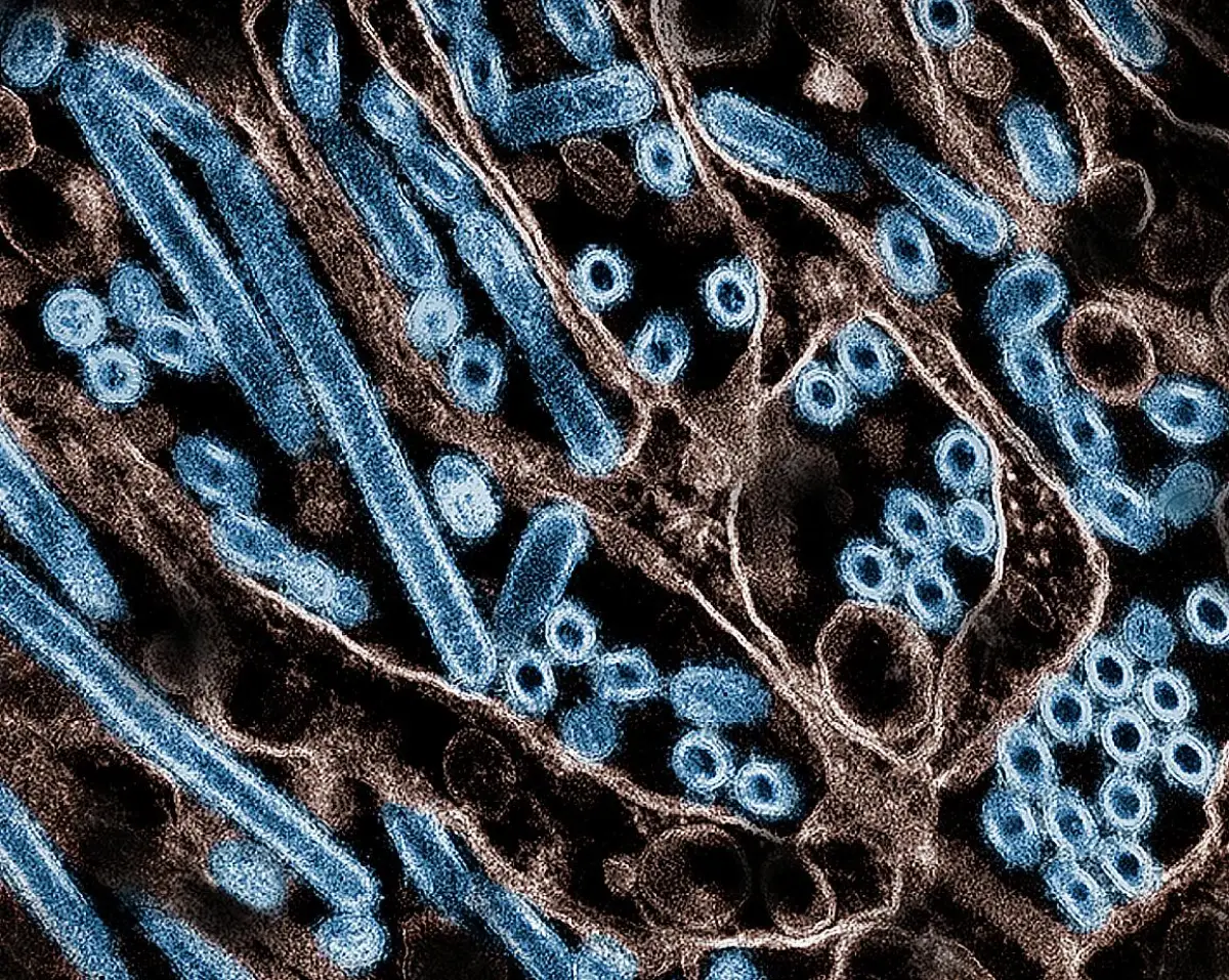 Primera muerte humana por gripe aviar H5N1 en Estados Unidos enciende alarmas