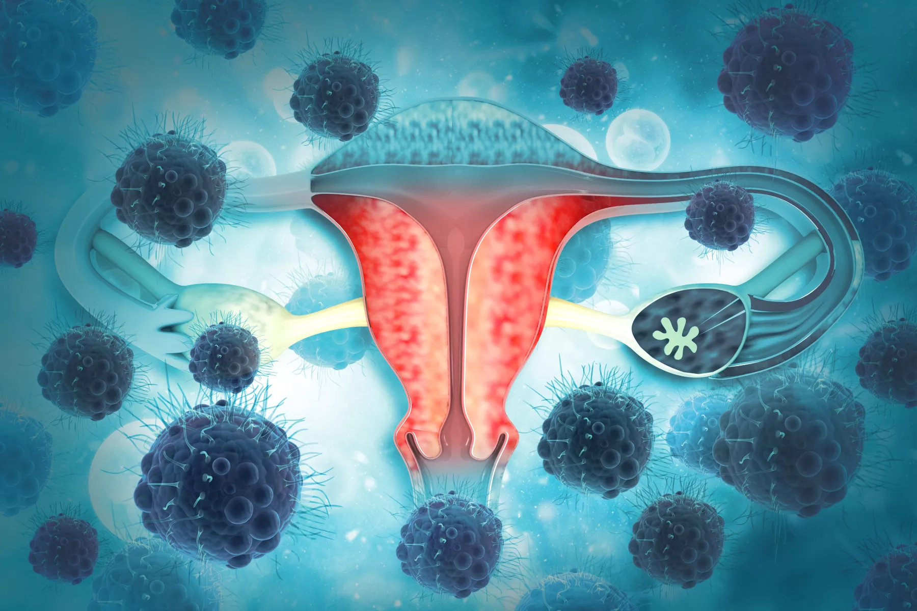 cancer cervicouterino