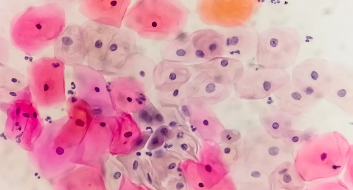 infecciones-que-causan-cancer.jpg