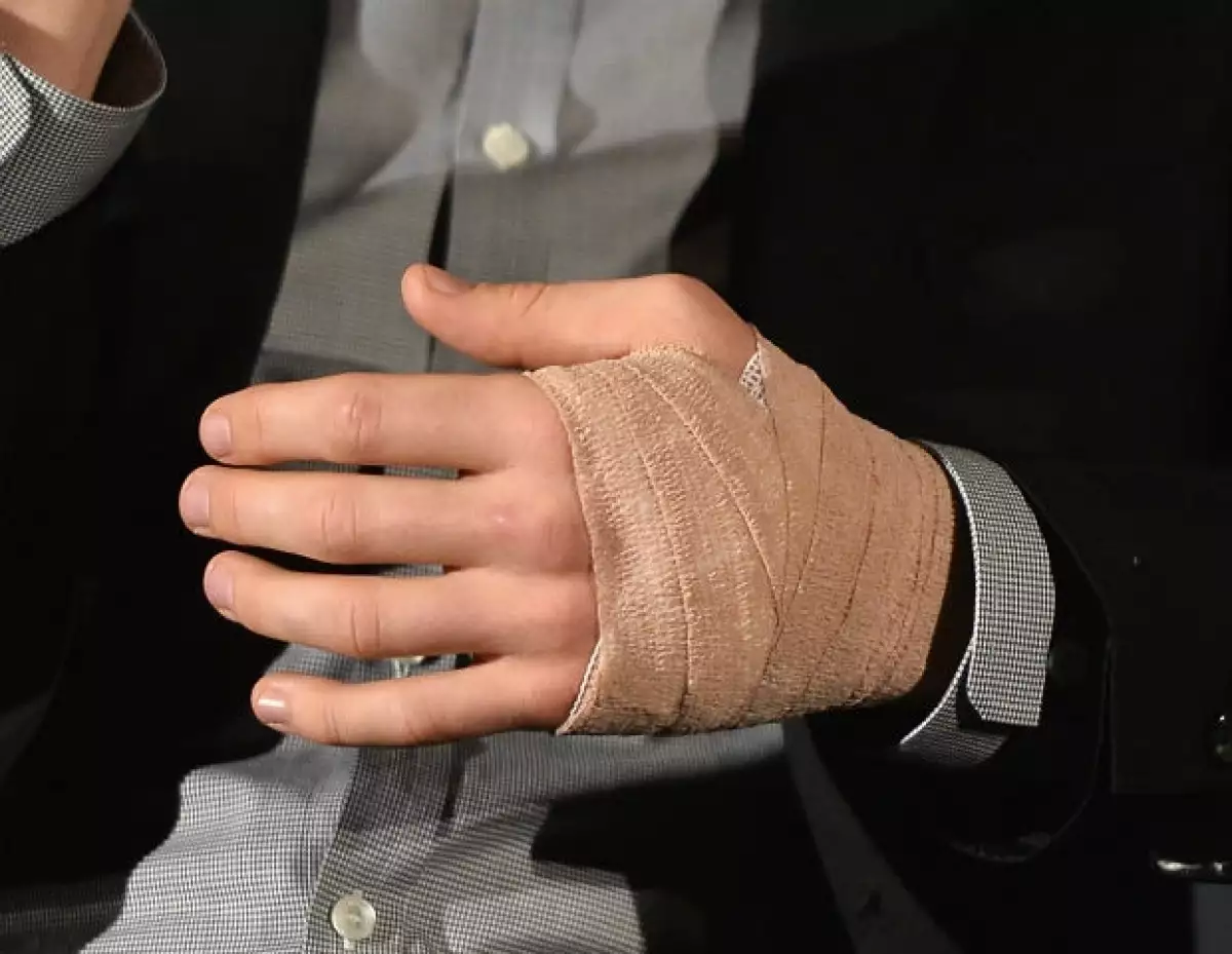 Después de que su mano recibió cortaduras durante la filmación de una película, el incidente no pasó a mayores y se ha reincorporado a sus actividades de promoción.