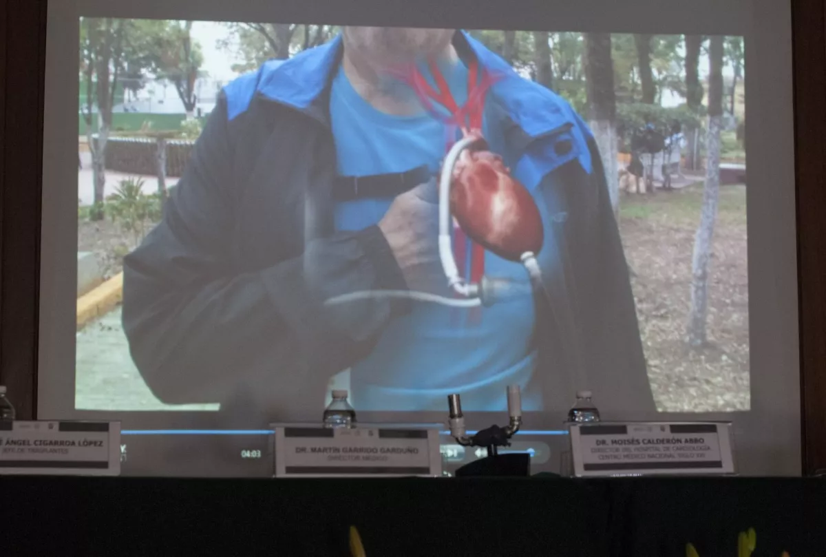 MÉXICO, D.F., 27MAYO2013.- Salvador Pérez Yáñez, de 68 años de edad; primer persona en América Latina en recibir un dispositivo de asistencia ventricular como terapia definitiva conocido como "corazón artificial". El Instituto Mexicano del Seguro Social se convirtió en la primera institución en América Latina en realizar un trasplante de este tipo.
FOTO: DIEGO SIMÓN SÁNCHEZ / CUARTOSCURO.COM