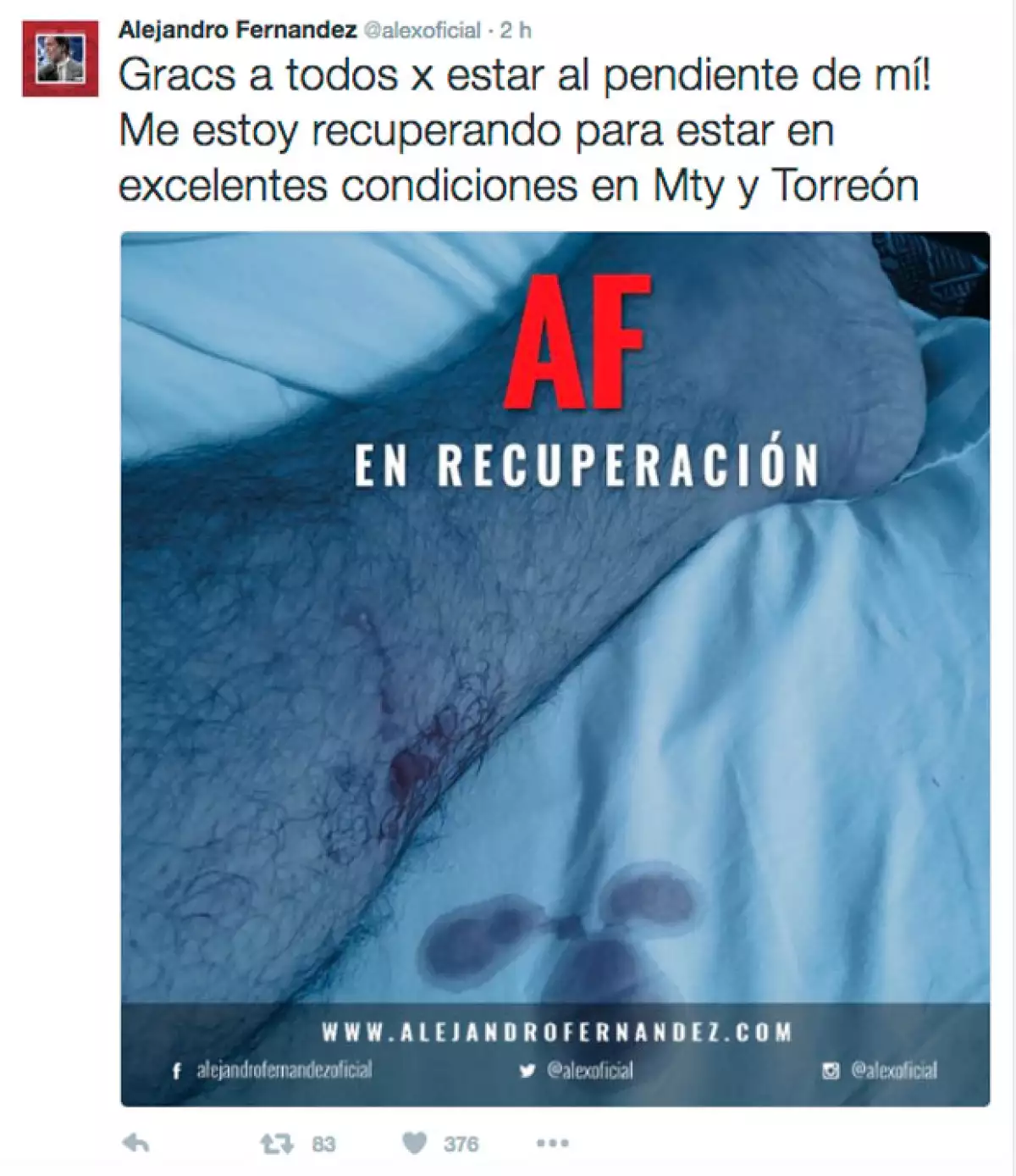 Con esta imagen, Alejandro informó a sus fans que a pesar del accidente se encontraba bien.