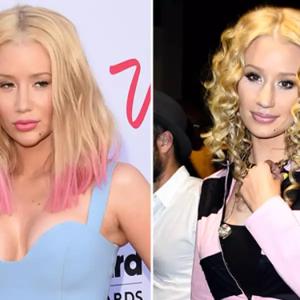 La rapera Iggy Azalea confirmó hace unos días haberse realizado cirugías estéticas para estilizar su rostro: Hay cosas que no me gustaban de mí y que cambié con cirugías. Hay otras cosas que no me gustan, pero que he aprendido a aceptar, dijo.