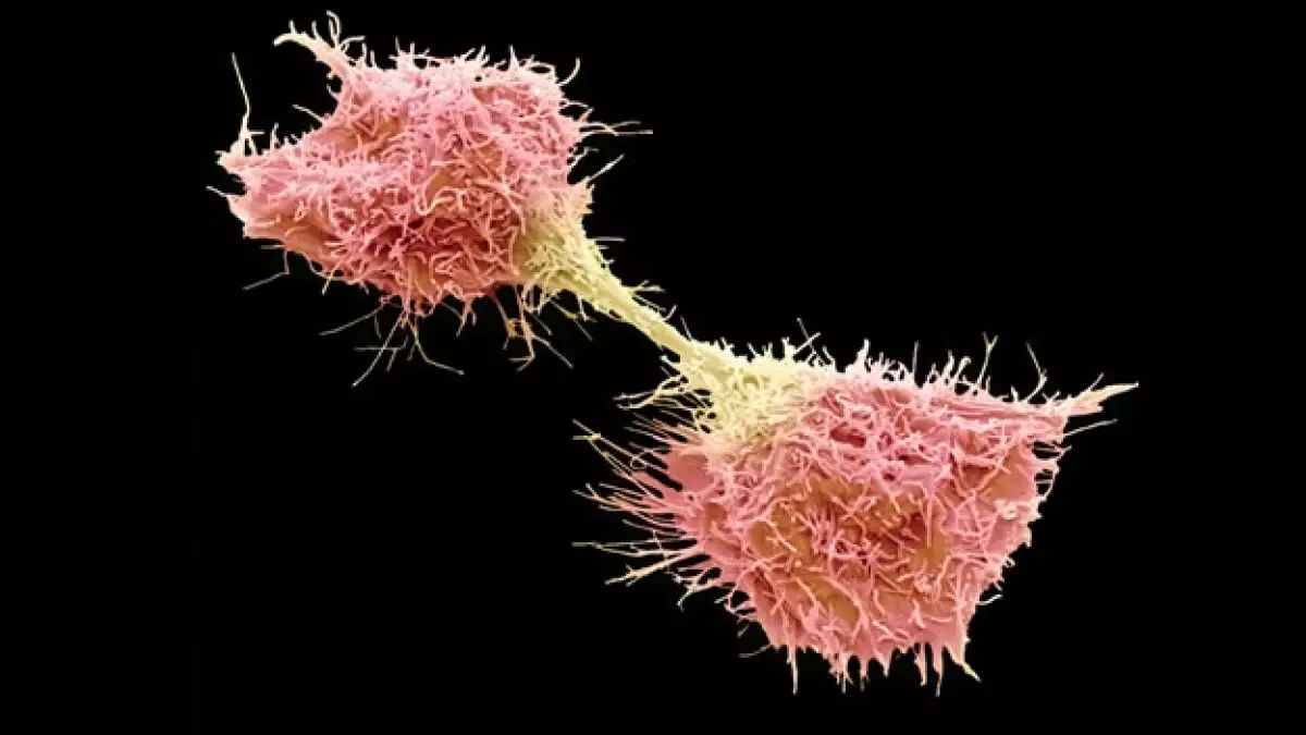 célula cancerígena