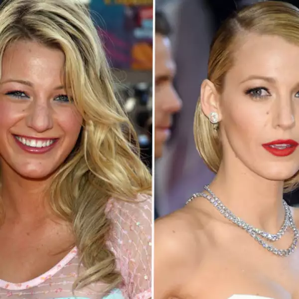 Blake Lively luce hoy un rostro casi perfecto, sin embargo, antes era notorio que tenía una nariz un poco más ancha.