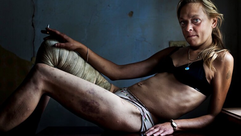 Maria, adicta a las drogas y prostituta, posa en uno de los cuartos donde trabaja en Kryvyi Rig, Ucrania, el 31 de agosto de 2011.