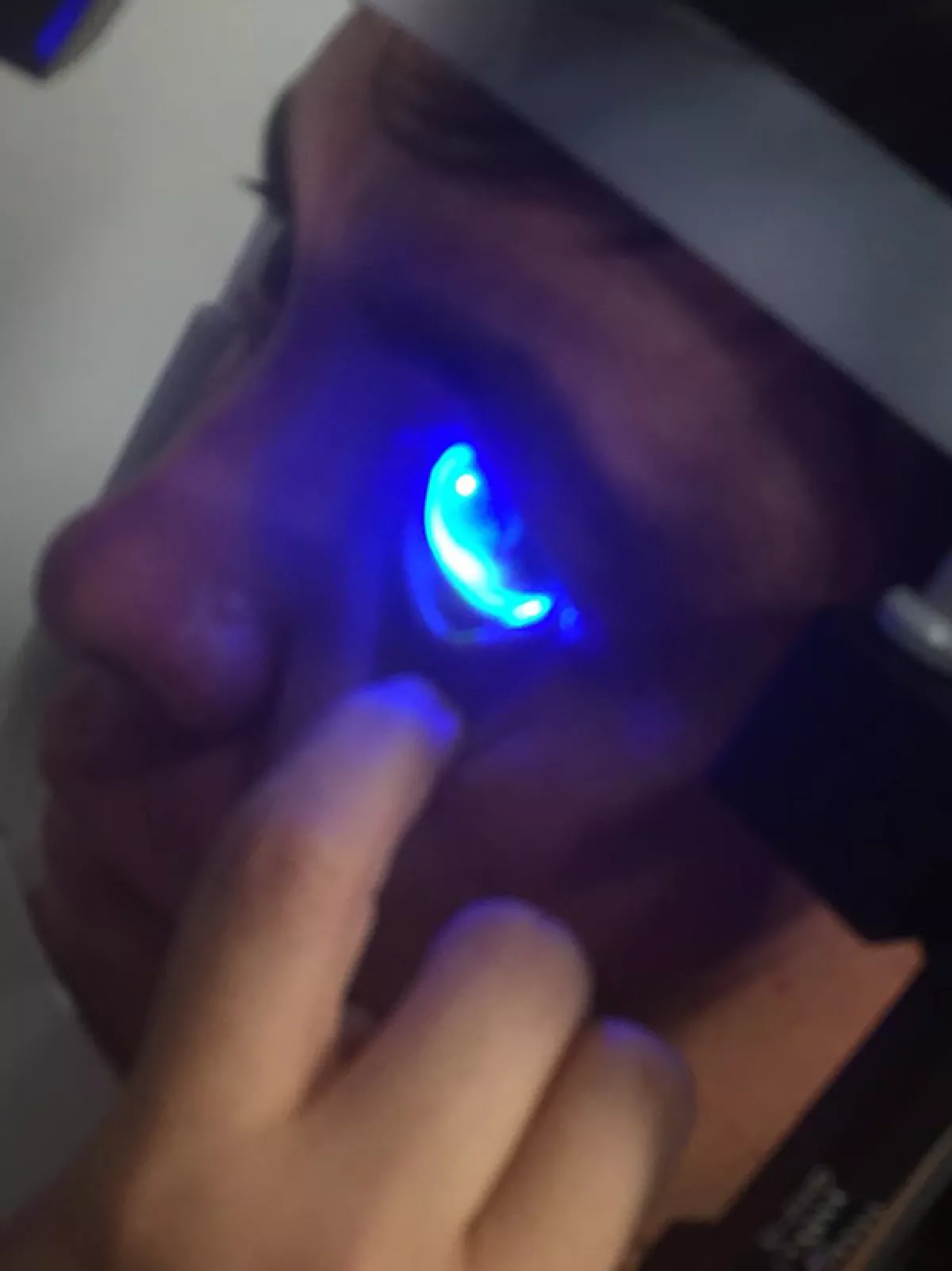 Kuno está a la espera de que le informen si el daño en su ojo es reversible.