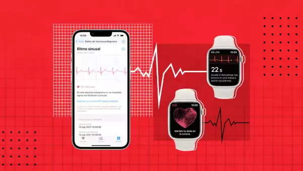 electro cardiograma- apple watch.jpg