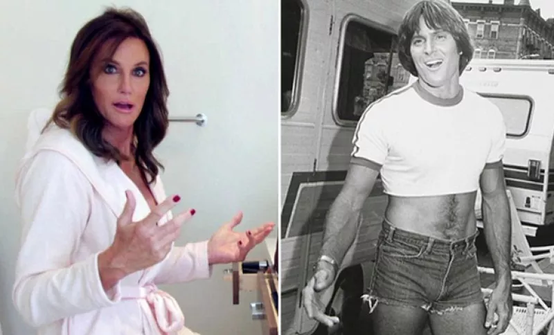 La transformación de Bruce Jenner en Caitlyn requirió una considerable suma de dinero, para que los detalles de su nuevo rostro quedaran impecables.