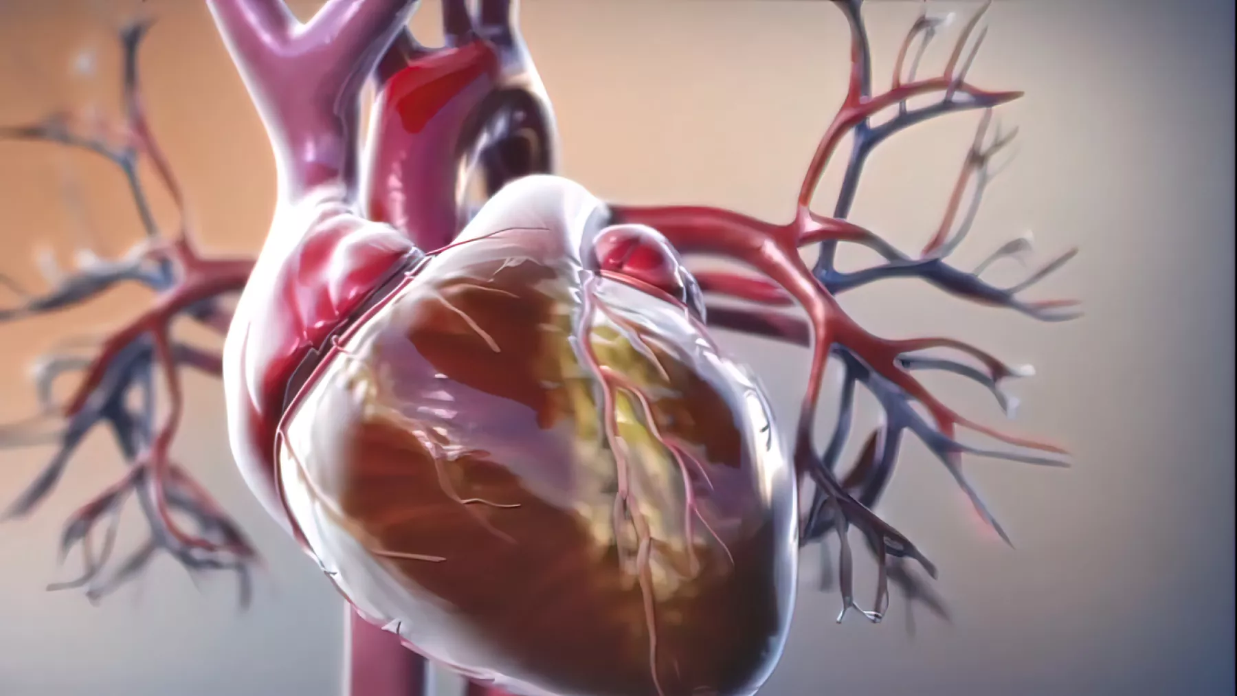 amiloidosis-cardiaca-enfermedades-raras