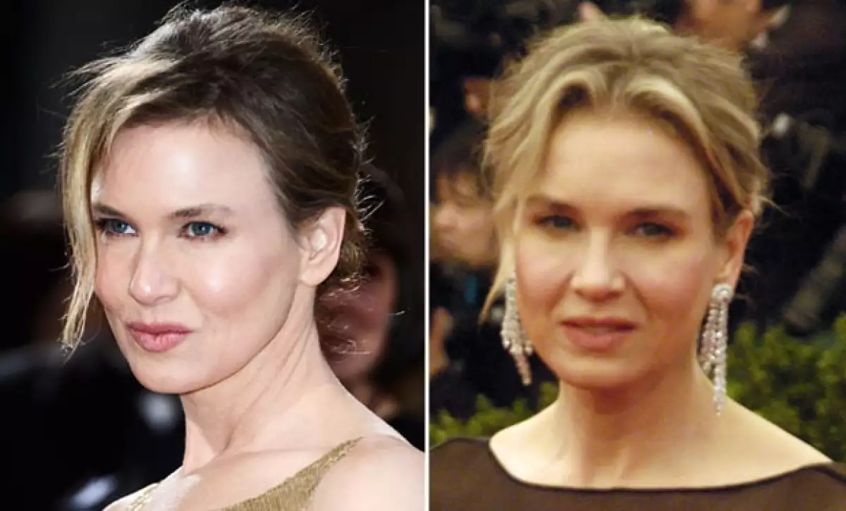 Renee Zellweger siempre ha dado una apariencia joven, pero hay ocasiones en que los famosos abusan de los retoques estéticos que no les favorecen.