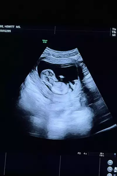 Pete Davidson y su novia esperan a su primer bebé