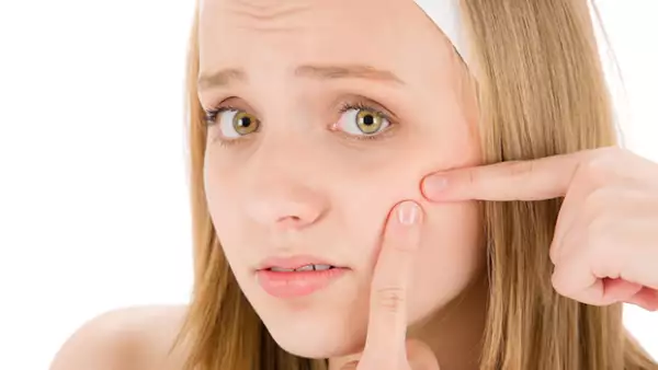 Sabemos lo molesto que puede ser el acné. Queremos que aprendas a evitarlo, a combatirlo y a entender realmente por qué aparecen los molestos granitos.