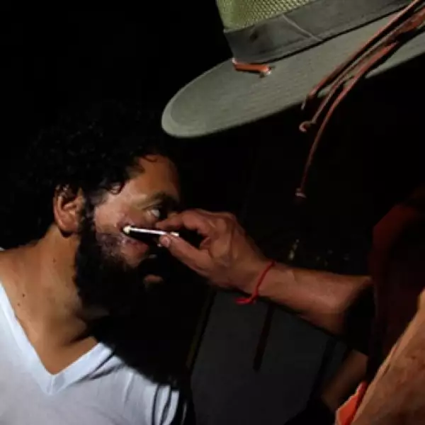 Judas tiene heridas en el rostro por sol