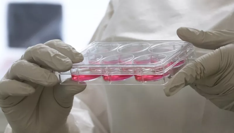 ebolatest