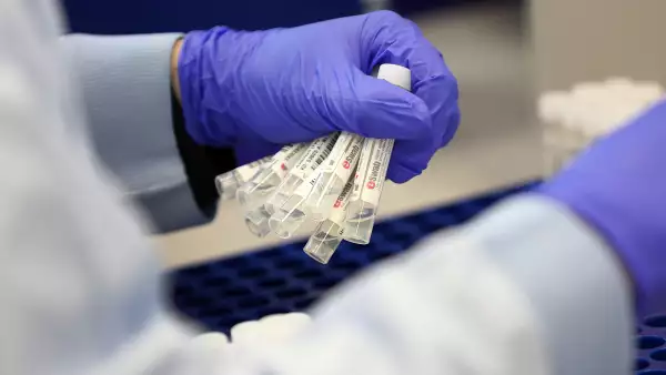 Una trabajadora de un laboratorio prepara muestras para hacer pruebas PCR para detectar el COVID-19. 