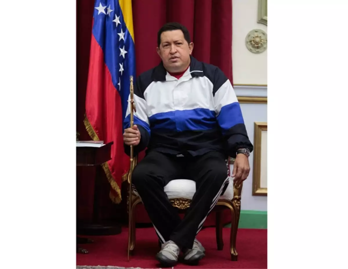 El estado de salud del presidente de Venezuela es delicado por complicaciones que no están exentas de riesgos, informó el vicepresidente de dicho país.